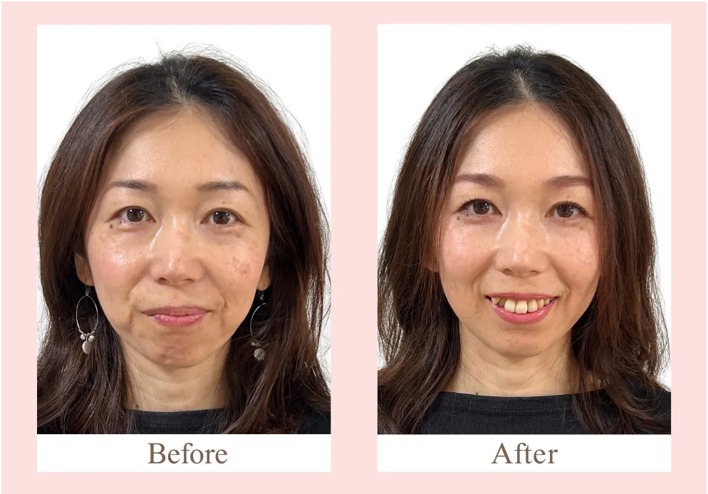 メイクでマイナス5歳